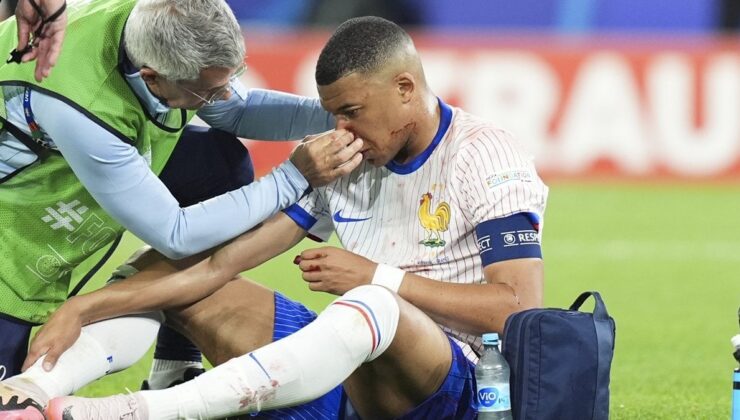 EURO 2024’te Bahtsız An: Mbappe’nin Burnu Kırıldı