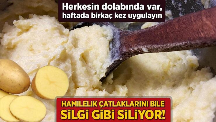 Hamilelik Çatlaklarını Bile Silgi Gibi Siliyor! Herkeste Var, Hafta Birkaç Kez Uygulayın