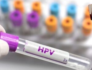 Hpv Virüsü Hakkında Doğru Bilinen Yanlışlar