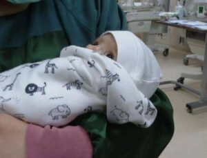 İnce Bağırsağı Tıkalı Doğan Bebeğe Çifte Operasyon
