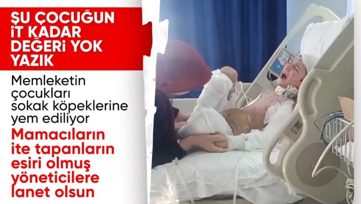 Köpek Saldırısında Ölümden Dönen Küçük Tunahan’ın Acı Dolu Tedavisi