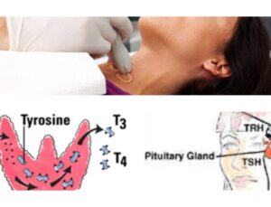 Tiroid Bezi Fonksiyon Testleri