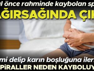 12 Yıl Önce Rahimde Kaybolan Spiral, Bağırsağında Çıktı | Bu Spiraller Neden Kayboluyor?