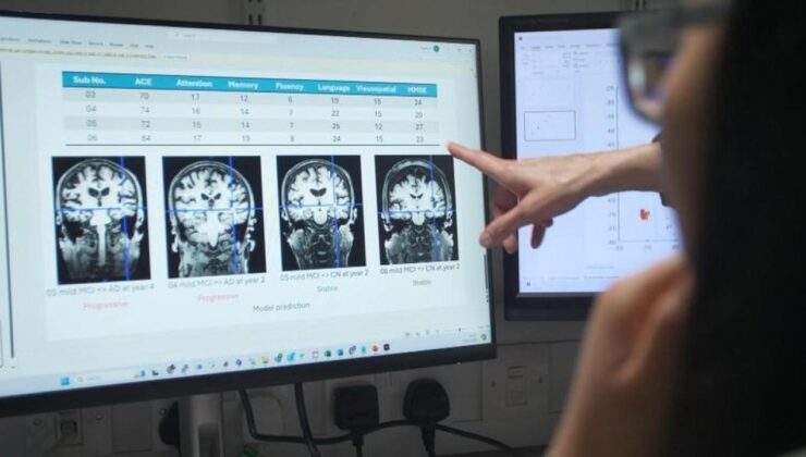 Alzheimer’a Karşı Mücadelede Oyunun Kurallarını Değiştirecek!