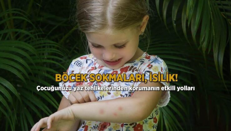 Böcek Sokmaları, İsilik! Çocuğunuzu Yaz Tehlikelerinden Müdafaanın Etkili Yolları