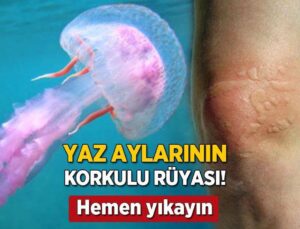 Denizanası Çarpması Yazın Korkulu Rüyası! Hemen Yıkayın, Bilinmeyen ‘Sirke’ Ayrıntısı