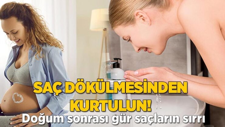 Doğum Sonrası Saçları Gürleştiren Mucize! Dökülmeden Eser Kalmıyor