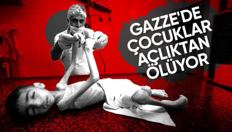 Gazze’de İnsanlık Ayıbı: Bir Çocuk Daha Açlıktan Öldü