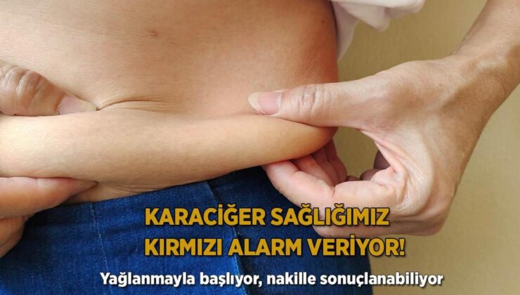 Karaciğer Sıhhatimiz Kırmızı Alarm Veriyor! Yağlanmayla Başlıyor, Nakille Sonuçlanabiliyor