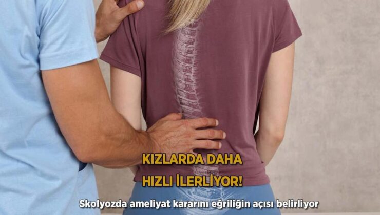 Kızlarda Daha Hızlı İlerliyor! Skolyozda Ameliyat Kararını Eğriliğin Açısı Belirliyor