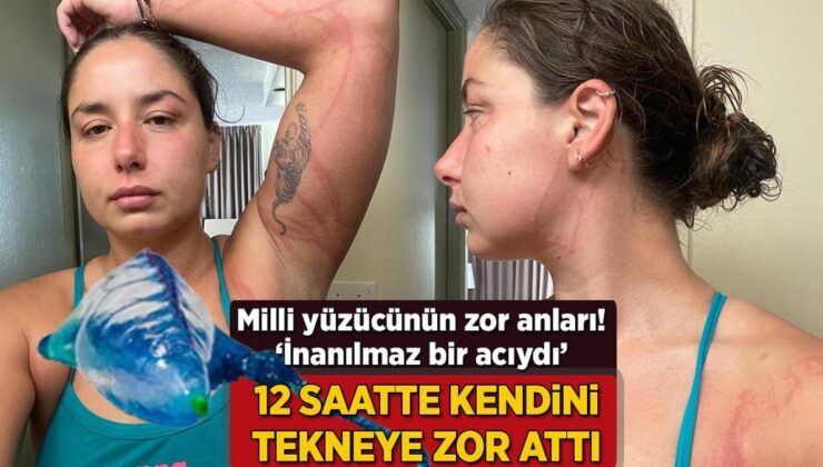 Milli Yüzücünün Zor Anları! 12. Saatte Kendini Tekneye Zor Attı: ‘İnanılmaz Bir Acıydı’