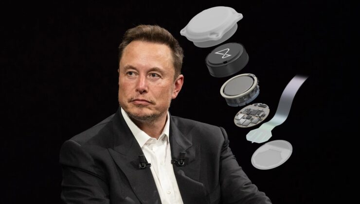 Musk’ın Neuralink Beyin Çipi İkinci Deneme İçin Hazır: Yenilikler Yapıldı