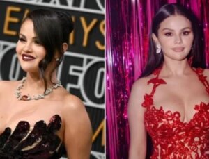 Selena Gomez, Bedeni Hakkında Yorum Yapan Hayranlarını Azarladı: ‘Botoks Yaptırdım, Beni Rahat Bırakın’