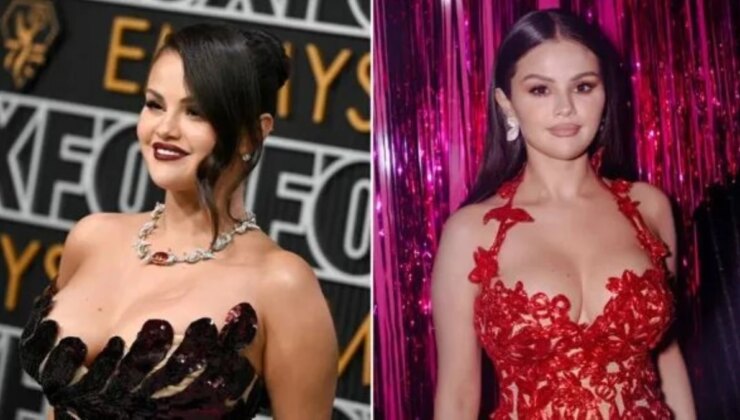 Selena Gomez, Bedeni Hakkında Yorum Yapan Hayranlarını Azarladı: ‘Botoks Yaptırdım, Beni Rahat Bırakın’