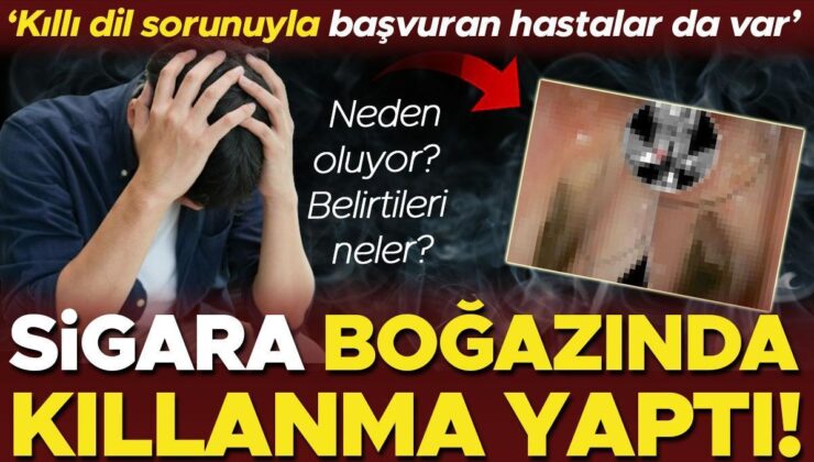 Tabipleri Bile Şaşırttı: Sigara Boğazında Kıllanma Yaptı! 14 Yıl Boyunca Devam Etti…  ‘Kıllı Dil Problemiyle Başvuran Hastalar da Var’