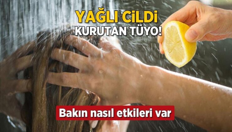 Yağlı Cilde İlaç Gibi Gelen Limon Suyu! Duşta Kullanın, Sivilce İzlerinden Eser Kalmıyor