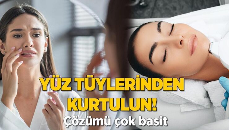 Yüzdeki Tüylerden Kurtulmanın Yolları! Hormonlarda Sorun Olabilir, Tahlili Basit