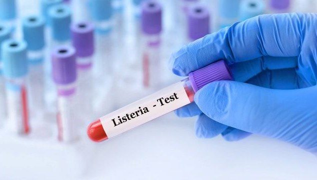 ABD’de Şarküteri Eserinden “Listeria” Bakterisi Bulaşan 9 Kişi Zehirlenerek Öldü