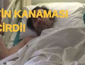 Kalp Krizi Geçiren Oyuncu Şimdi de Beyin Kanaması Geçirdi! 