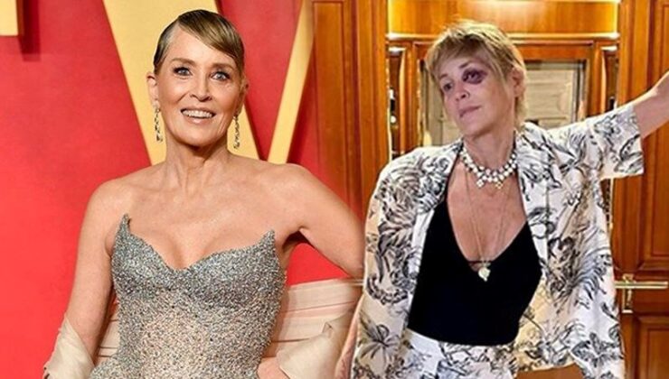 Ünlü Oyuncu Sharon Stone’un Gözüne Ne Oldu?