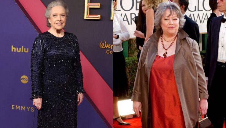 45 Kilo Verdi! Oscar Ödüllü Oyuncu Kathy Bates’i Görenler Tanıyamadı