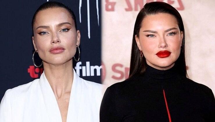 Adriana Lima’nın Yeni Görüntüsü Şaşırttı: Dolgularını Mı Eritti?