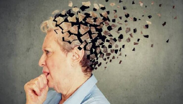 Türkiye’de Yaklaşık 800 Bin Alzheimer Hastası Var: Kadınlarda Risk Daha Yüksek