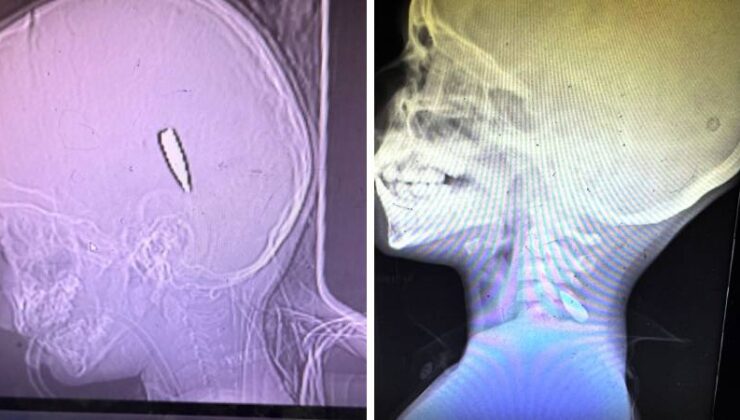 65 Doktor, Hemşire ve Sağlık Görevlisi Gazze’de Gördüklerini Anlattı: Başından Vurulmuş 18 Aylık Bebek, Ölmeyi İsteyen Çocuklar ve Açlık…