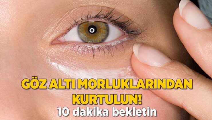 Göz Altı Morluklarından Kurtulmanın Yolu! 1 Dilimi Bile Aydınlatıyor, 10 Dakika Yeterli