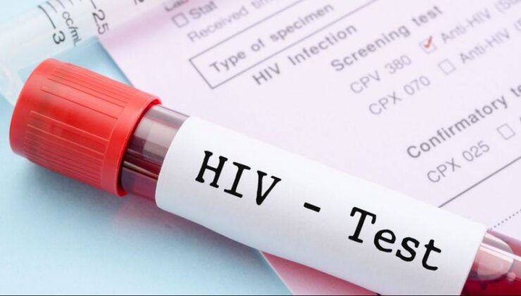 HIV’de Artış 15-24 Yaş Grubunda Daha Fazla