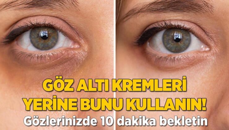 Krem Yerine Bunları Kullanın! 10 Dakika Bekletince Şişlik Kalmıyor