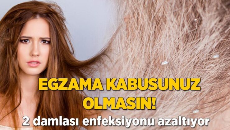 Saç Egzaması Kabusunuz Olmasın! 2 Damlası Enfeksiyonu Azaltıyormuş