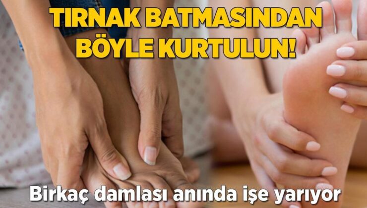 Tırnak Batmasından Böyle Kurtulun! Birkaç Damlası Anında İşe Yarıyor