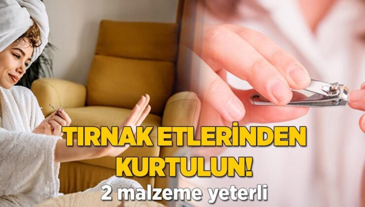 Tırnak Etlerinden Kurtulmanın En Etkili Yoluymuş! 2 Materyal Yeterli