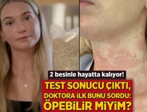 2 Besinle Hayatta Kalıyor! Test Sonucu Çıktı, Doktora İlk Bunu Sordu: ‘Öpebilir Miyim?’