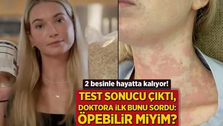 2 Besinle Hayatta Kalıyor! Test Sonucu Çıktı, Doktora İlk Bunu Sordu: ‘Öpebilir Miyim?’