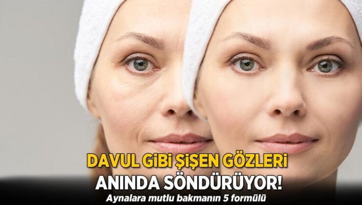 Davul Gibi Şişen Gözleri Anında Söndürüyor! Aynalara Mutlu Bakmanın 5 Formülü