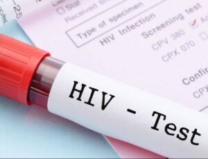 Dünya Genelinde HIV Enfeksiyonuyla Yaşayan 39,9 Milyon Kişiden 9,3 Milyonu Tedaviye Erişemiyor