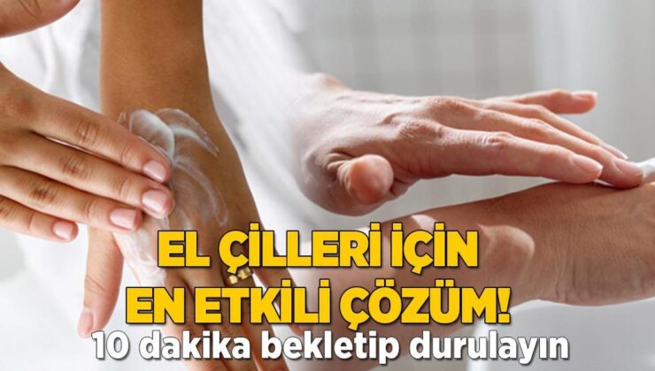 Elde de Oluşuyor, Çiller İçin En Etkili Çözüm! 10 Dakika Bekletip Durulayın