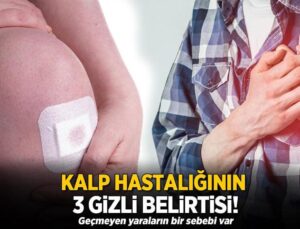 Kalp Hastalığının 3 Gizli Belirtisi! Geçmeyen Yaraların Bir Sebebi Var