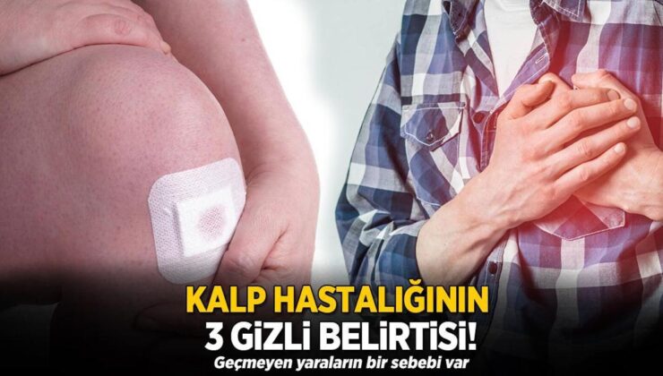 Kalp Hastalığının 3 Gizli Belirtisi! Geçmeyen Yaraların Bir Sebebi Var