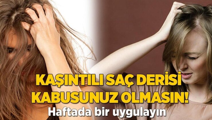 Kaşıntılı Saç Derisi Kabusunuz Olmasın! Haftada Bir Uygulamak Şart