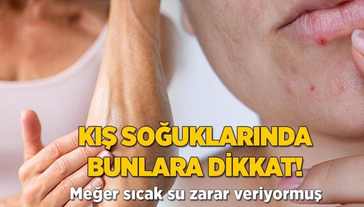 Kış Soğuklarında Bunlara Dikkat! Meğerse Sıcak Su Zarar Veriyormuş