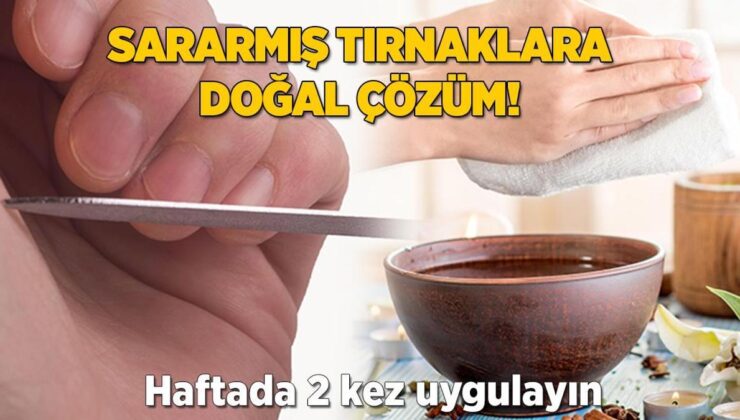 Sararmış Tırnaklara Doğal Çözüm! Haftada 2 Kez Uygulayınca Düzeliyor