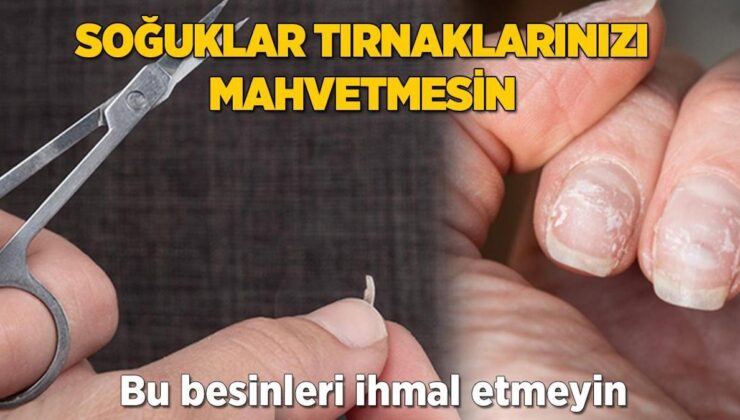 Soğuk Hava Mahvediyormuş! Bu Besinleri Yiyenler Korkmuyor, Taş Gibi