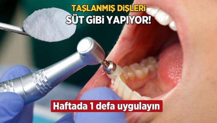 Taşlanmış Dişleri İnci Gibi Yapan Karbonat Tüyosu! Haftada 1 Uygulayın, Sonuç Tertemiz