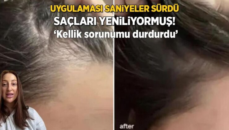 Uygulaması 1 Dakikanızı Bile Almaz! Kellik Sorununu Yok Ediyor, ‘Resmen Saçımı Yeniledi’