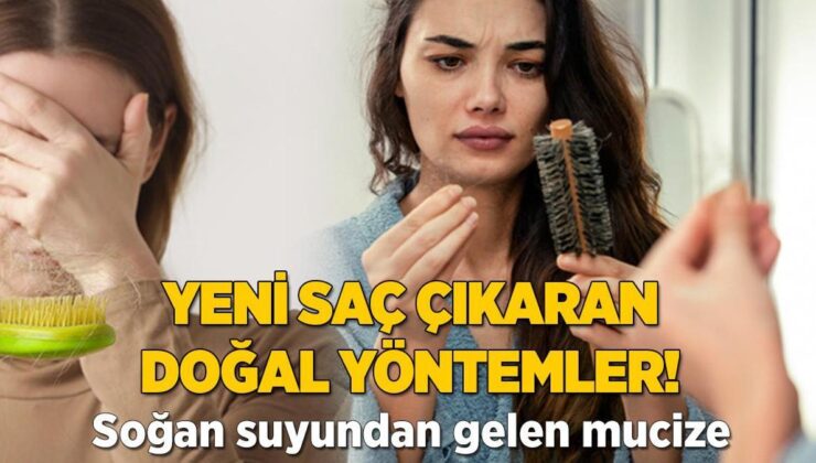 Yeni Saç Çıkaran Doğal Yöntem! Etkisi Soğan Suyundan Geliyormuş