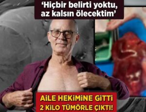 Aile Doktoruna Gitti, 2 Kilo Tümörle Çıktı! ‘Hiçbir Belirti Yoktu, Az Kalsın Ölecektim’