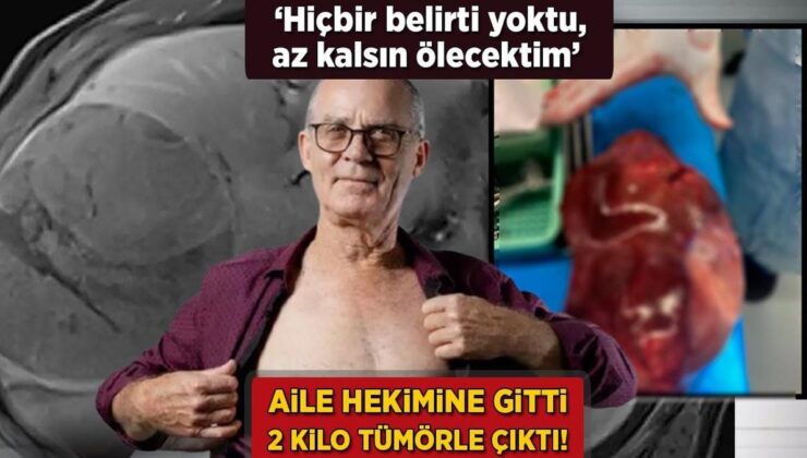 Aile Doktoruna Gitti, 2 Kilo Tümörle Çıktı! ‘Hiçbir Belirti Yoktu, Az Kalsın Ölecektim’